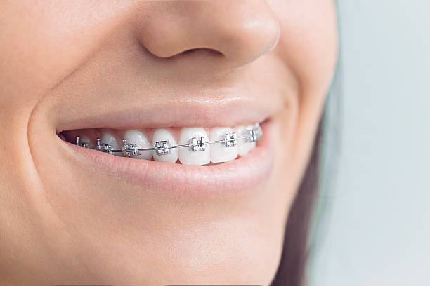 Best Dental Inlays and Onlays  in St Martinville, LA